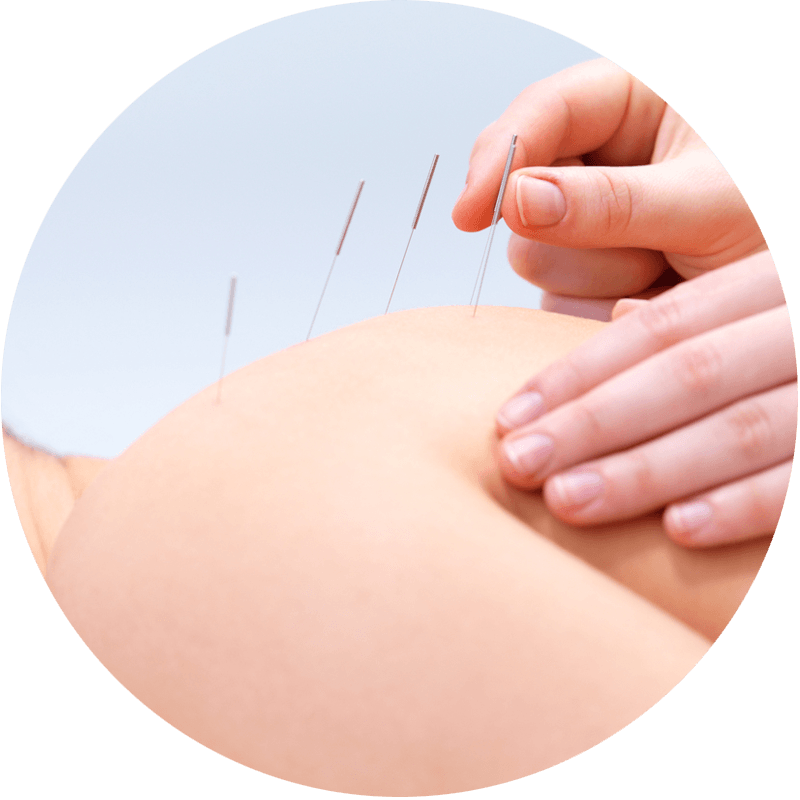 Chiropractic Middletown NY Acupuncture Slider